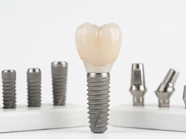Implantes dentales en OdontoDemo Montevideo