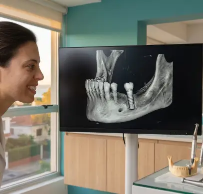 Tratamiento de implantes dentales en SmileDemo